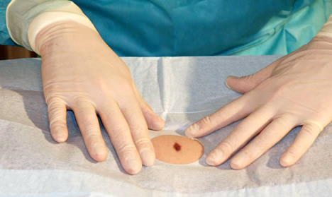 Dermatological Procedures